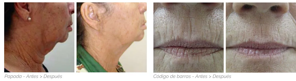 tratamiento facial