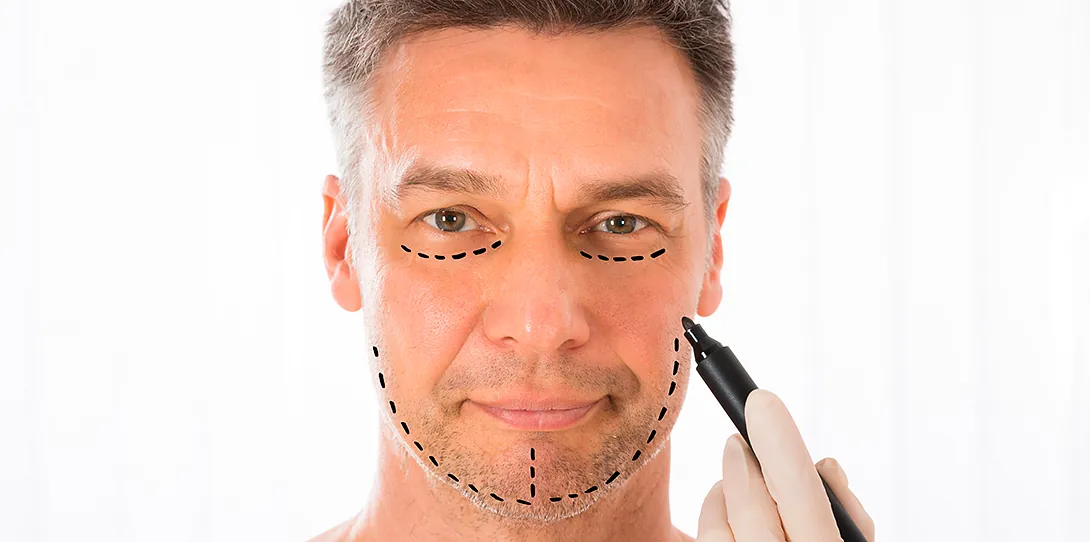 Tratamientos Faciales